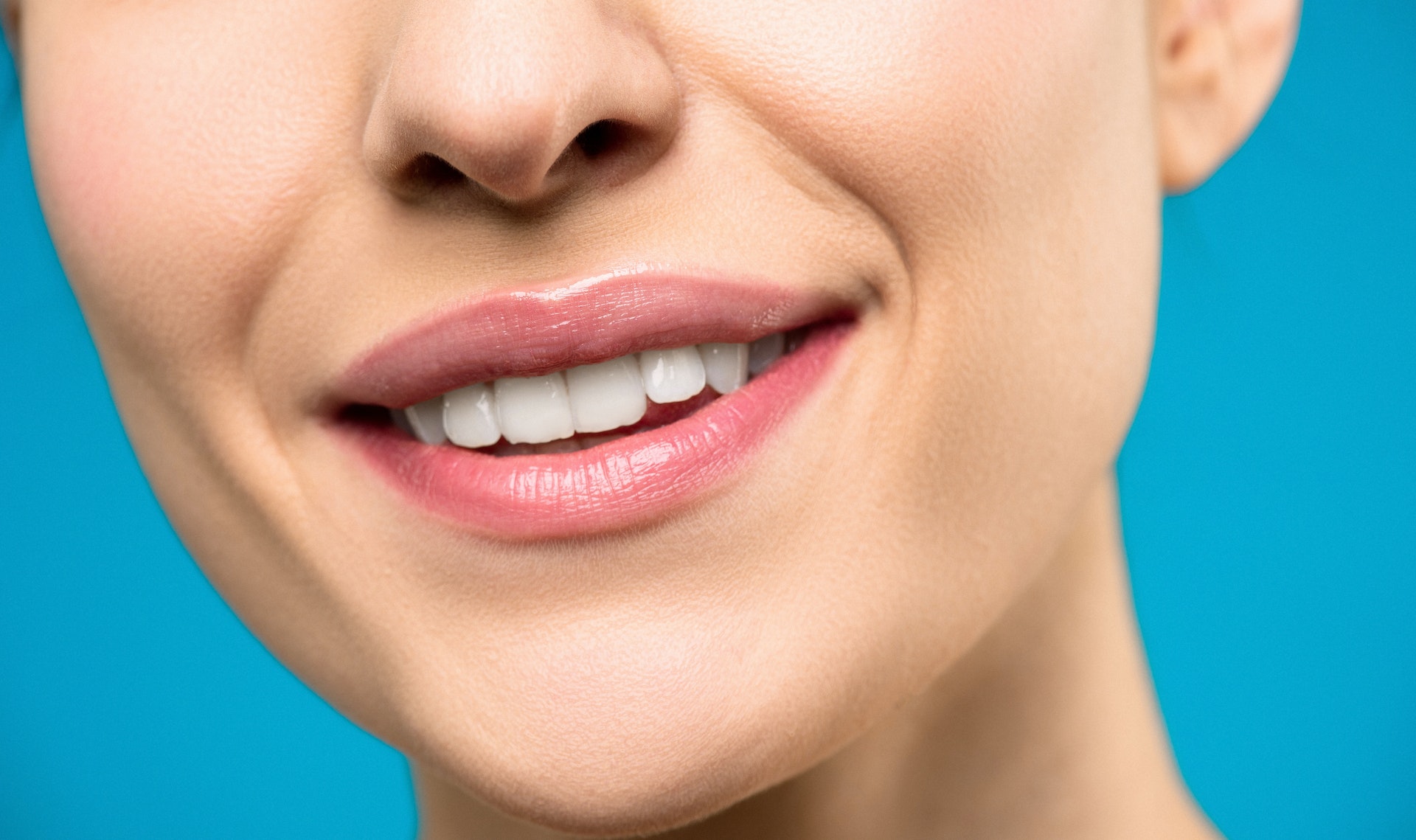 Featured image for “Brighten Your Smile with Teeth Whitening In San Diego”